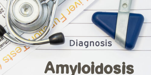 Two Types of Hereditary Amyloidosis You Need to be Aware of