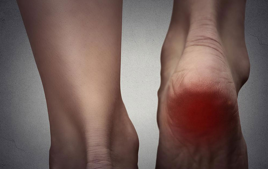 Understanding Burning Foot Pain and its Treatment Options