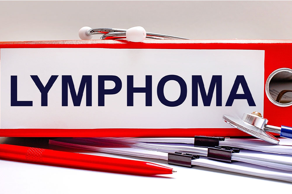 All you need to know about B-cell follicular lymphoma