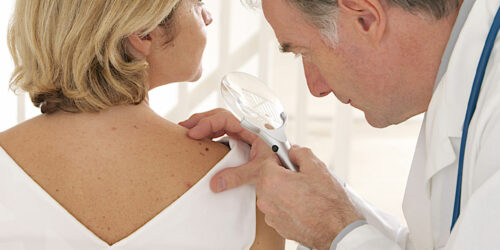 Perioral Dermatitis – Signs, Causes, Diagnosis, and Management