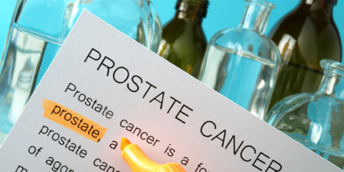 Prostate Cancer Symptoms