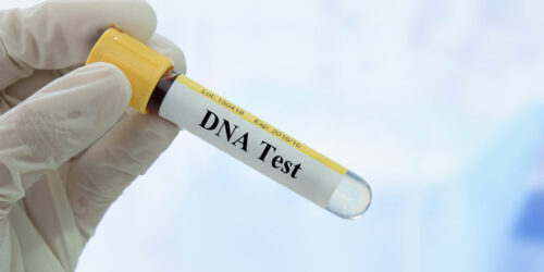 Things to Know Before Taking a DNA Test