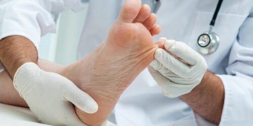 Common Symptoms, Diagnosis, and Remedies of Nail Psoriasis