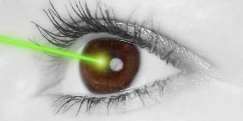 Lasik Eye Surgery Cost And Procedure