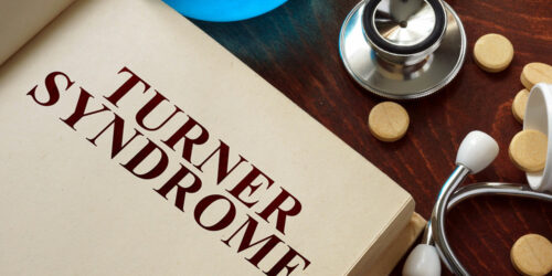 Turner Syndrome &#8211; Causes, Symptoms, and Management