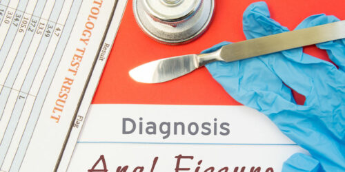 Anal Fissures &#8211; Its Causes, Symptoms, and Management