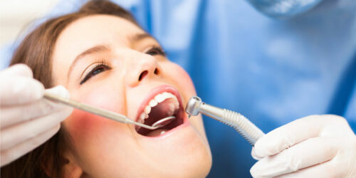 Here&#8217;s Everything to Know About Dental Bridging