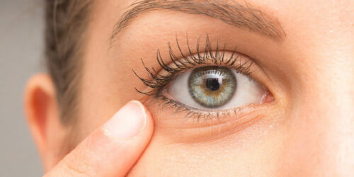 Tips to Find a Surgeon for Eye Bag Removal