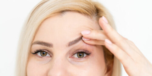 Management Options to Fix Droopy Eyelids