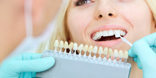 4 Common Types of Dental Implants and Their Costs