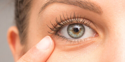 Eye Twitching – Types, Causes, and Remedies